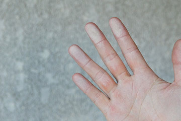 チョーキング チョーキング